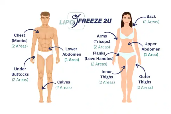 Areas you can have fat freezing treatment Crawley
