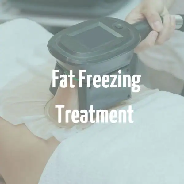 fat freezing treatment Crawley