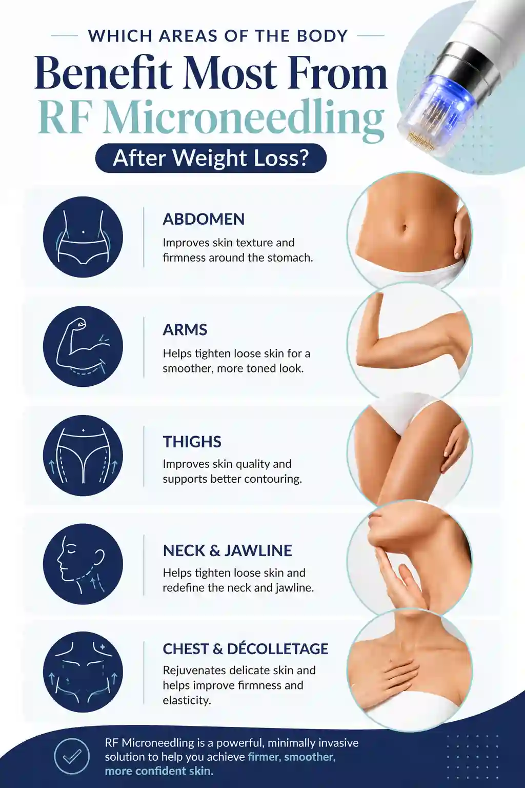 Which Areas of the Body Benefit Most From RF Microneedling After Weight Loss Crawley